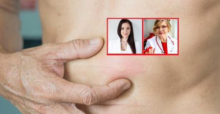 Zmiany na skórze zwiastują ukryte choroby. "Nie powinniśmy lekceważyć"
