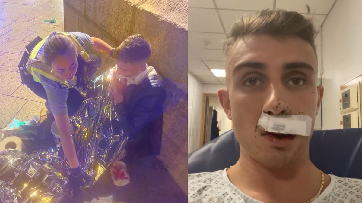 Olimpijczyk zaatakowany w centrum miasta 