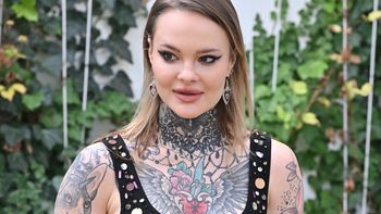 Monika Miller cierpi na fibromialgię. Lekarze często ją bagatelizują