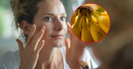 Potarła twarz skórką banana. Już po 30 min zobaczyła efekt