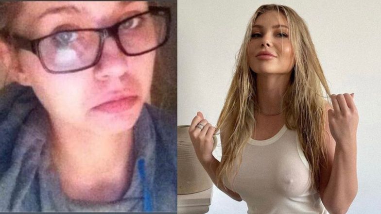 Martyna Kondratowicz pokazała zdjęcia sprzed operacji plastycznych 