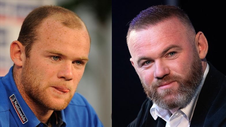 Wayne Rooney 