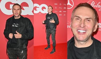 Krzysztof Gojdź z dumą prezentuje NOWE ZĘBY i rezultaty liftingu za 150 TYSIĘCY. Ładnie wyszło? (ZDJĘCIA)