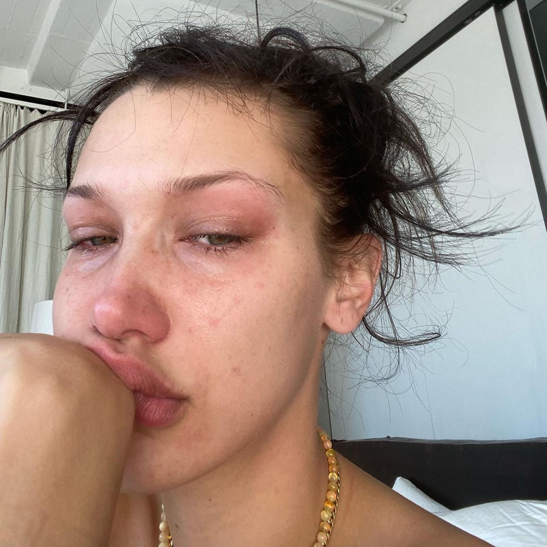 Bella Hadid o zdrowiu psychicznym