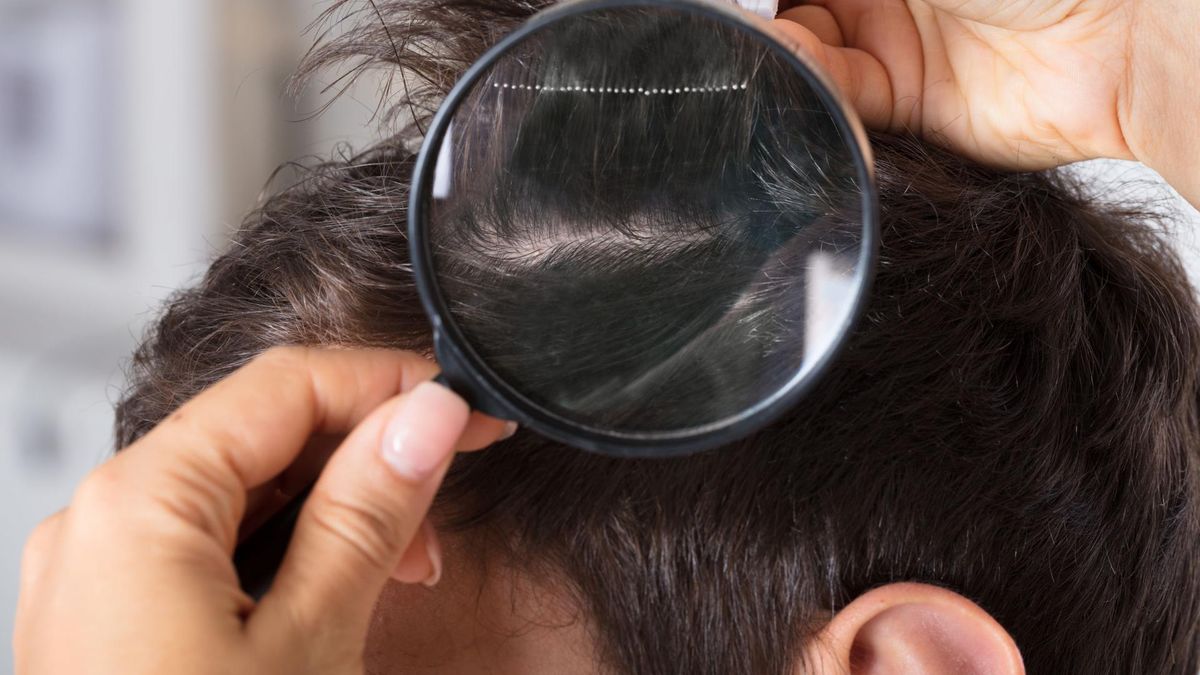 Badanie włosów może zapobiec rozwojowi wszawicy