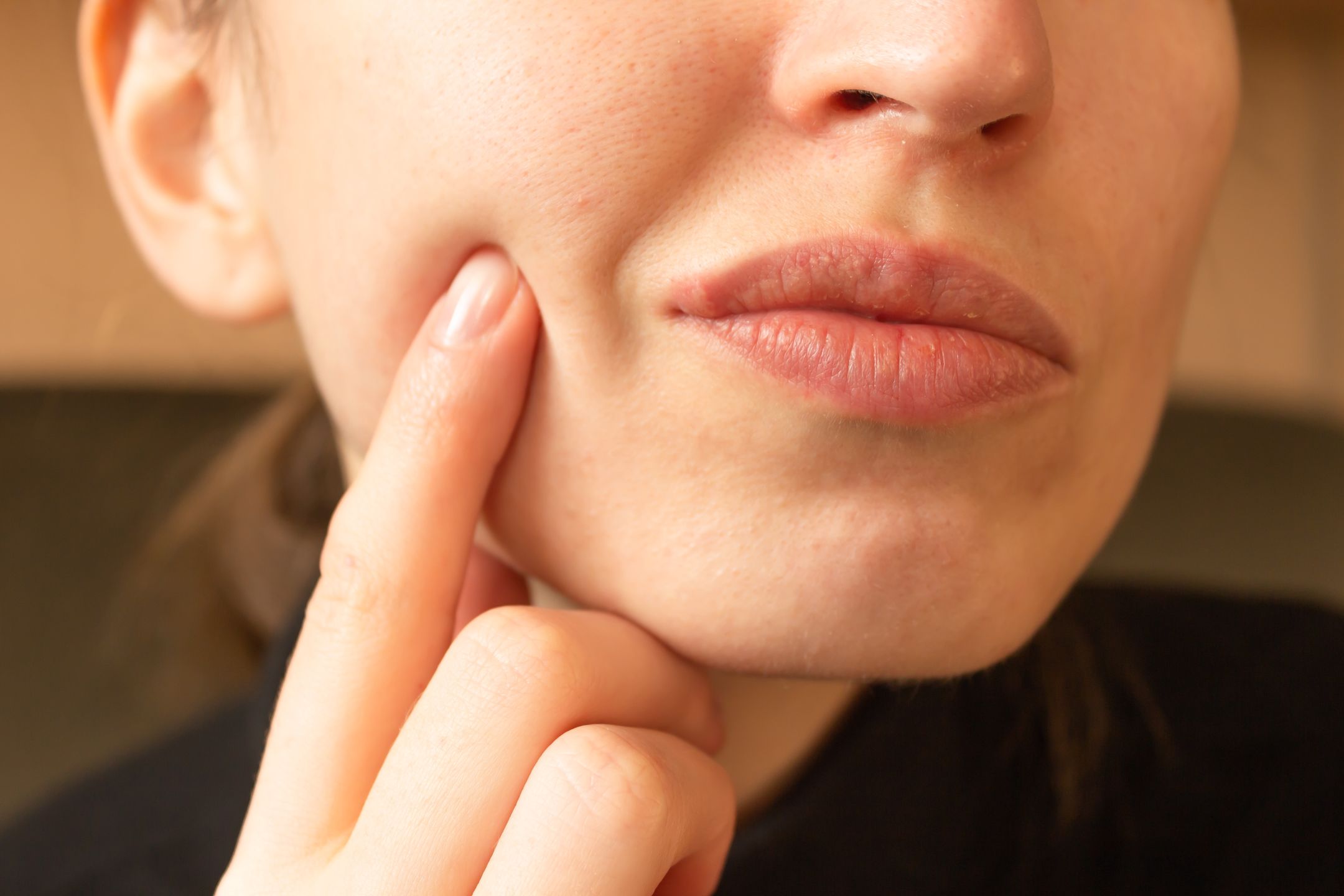 Young woman points her finger at her lips infected herpes virus. Indignation look. Diseases of the immune system.
Young woman points her finger at her lips infected herpes virus. Indignation look. Diseases of the immune system in winter and spring. Skin and health care. Horizontal photo. Close-up.
herpes, virus, lip, woman, face, touching, genetic, dermatology, cold, skincare, ugly, finger, unhealthy, pain, disease, spring, infection, mouth, illness, skin, sore, blister, person, problem, suffering, inflammation, medicine, hand, fever, complaint, sensitive, disgusting, health care, immunity, hurt, symptom, contagion, show, wellness, wellbeing, flu, cold sore, human lips, natural, pimple, looking, dissatisfied, virulent, young, closeup, herpes, virus, lip, woman, face, touching, genetic, dermatology, cold, skincare, ugly, finger, unhealthy, pain, disease, spring, infection, mouth, illness, skin, sore, blister, person, problem, suffering, inflammation, medicine, hand, fever, complaint, sensitive, disgusting, health care, immunity, hurt, symptom, contagion, show, wellness, wellbeing, flu, cold sore, human lips, natural, pimple, looking, dissatisfied, virulent, young