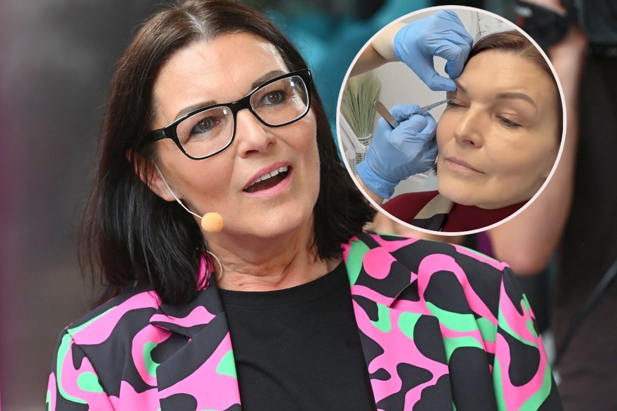 Ilona Felicjańska poddała się zabiegowi BLEFAROPLASTYKI. Pokazała zdjęcia