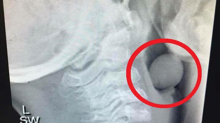 Lekarz pokazał zdjęcie RTG.