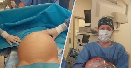Sukces lekarzy z Białegostoku. Potworniak ważył 16 kilogramów