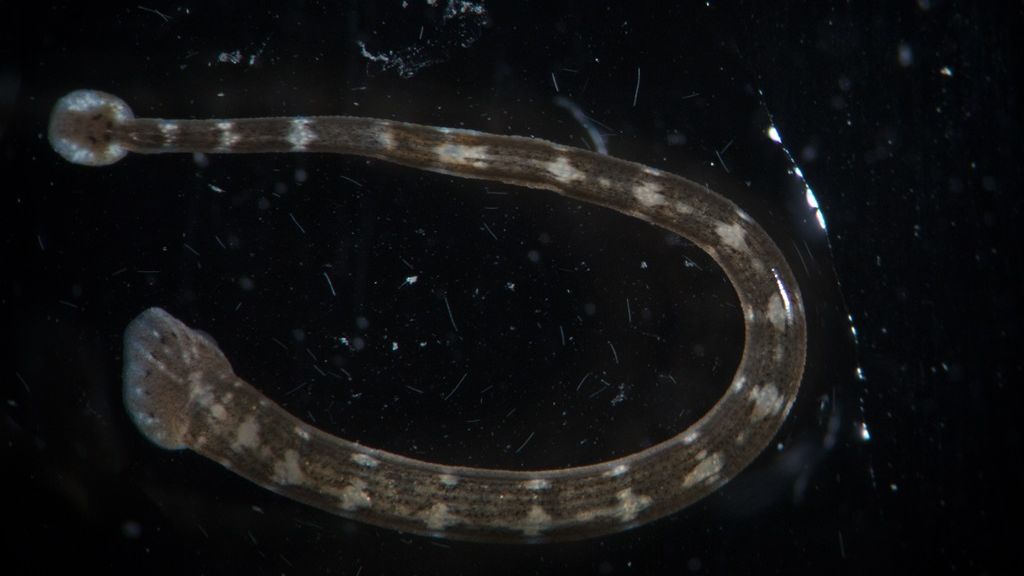 Choroby pasożytnicze wywołuje m.in. glista ludzka i tasiemiec