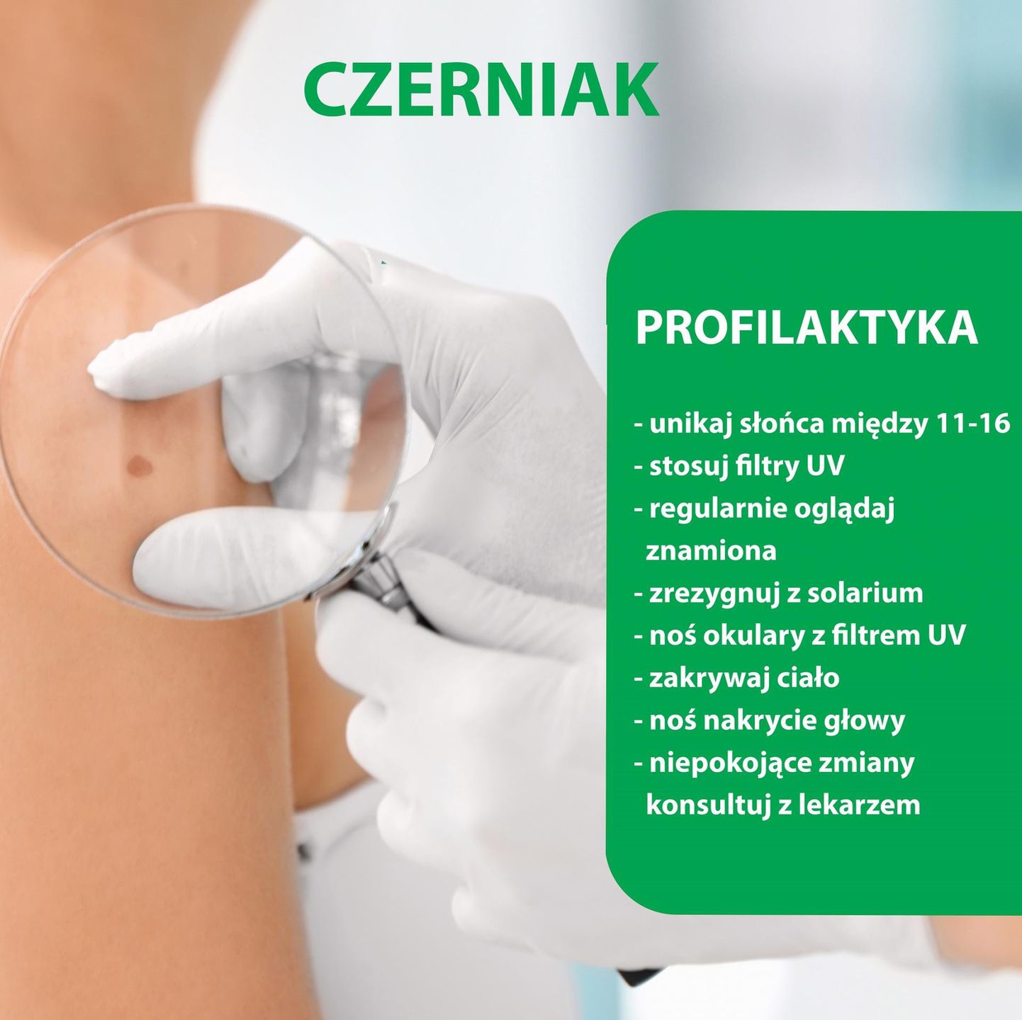 Odpowiednia profilaktyka znacząco zmniejsza ryzyko rozwoju czerniaka