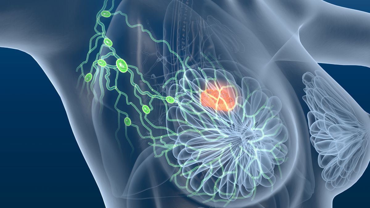 Powiększone węzły chłonne wskazują na wiele chorób