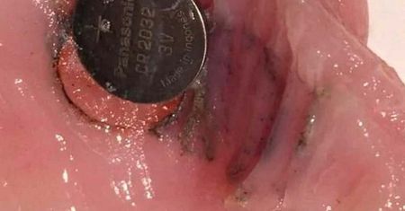 Pielęgniarka ostrzega. W kilka godzin może dojść do nieodwracalnych uszkodzeń