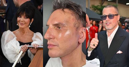 TYLKO NA PUDELKU: Krzysztof Gojdź pokazał się przed i po liftingu za 150 tys zł. "Tą samą metodą, którą mieli Jenner i Pitt"