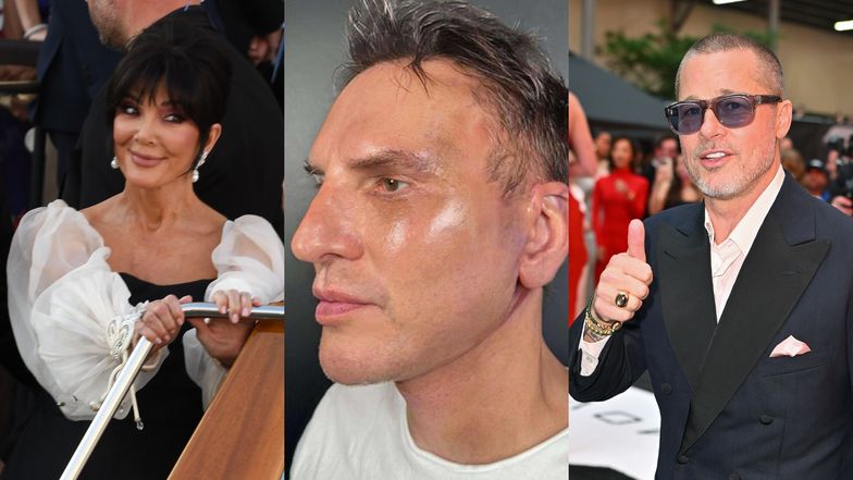 Krzysztof Gojdź pokazał się "przed" i "po" kosztownym liftingu