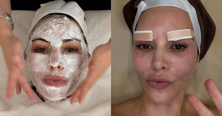 Kim Kardashian pozdrawia z zabiegu upiększania i martwi fanów: "Co ty sobie wstrzykujesz w ramię?!"