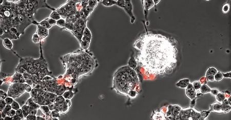 Tak koronawirus infekuje mózg. Naukowcy pokazali szokujące nagranie