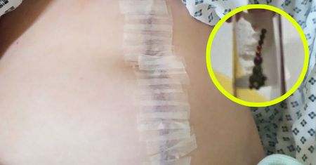 13-latka chciała odtworzyć trend z TikToka. W ciężkim stanie trafiła do szpitala