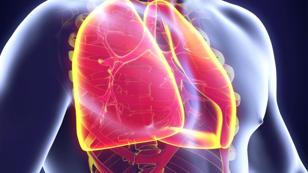 Rzadka przypadłość. Jak rozpoznać zawał płuc? (WIDEO)