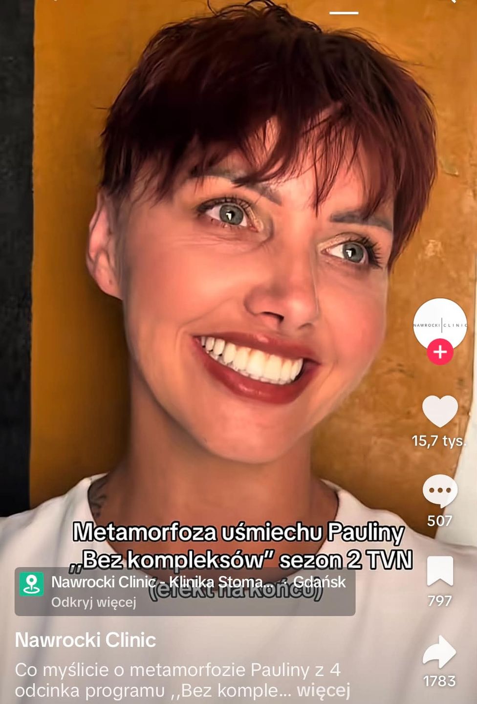 Metamorfoza zębów uczestniczki w programie "Bez kompleksów"