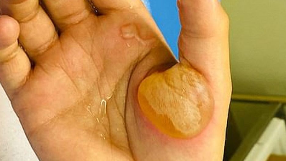 Niebezpieczne wyzwanie na TikToku. Próbują wykonać plaster miodu ze Squid Game