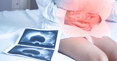 Powikłania torbieli jajnika – pęknięcie, skręcenie, problemy związane z ciążą