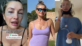 Wydała KILKADZIESIĄT TYSIĘCY na metamorfozę w Turcji. Nie uwierzycie, ile influencerka naprawdę ma lat