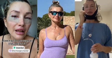 Wydała KILKADZIESIĄT TYSIĘCY na metamorfozę w Turcji. Nie uwierzycie, ile influencerka naprawdę ma lat