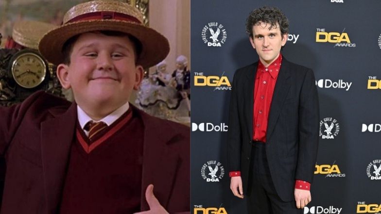 Harry Melling zmienił się nie do poznania 