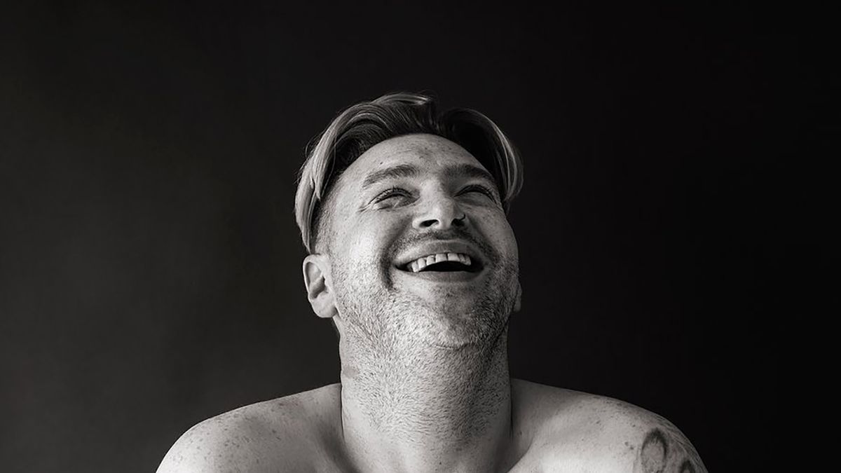 Kelly Jay zrobiła zdjęcia osób z bliznami, by pokazać ich historie 1