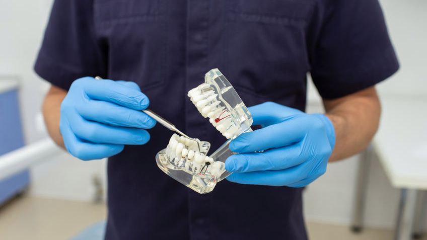 Nieodwracalne zapalenie miazgi zębowej - miazga zębowa, przyczyny, etapy zapalenia, skutki uboczne