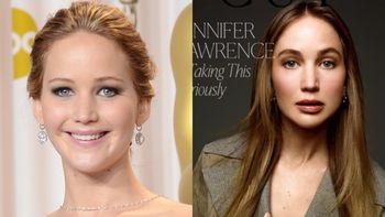 Lekarze wzięli pod lupę "NOWĄ TWARZ" (?) Jennifer Lawrence. Wymieniają, co MOGŁA SOBIE POPRAWIĆ