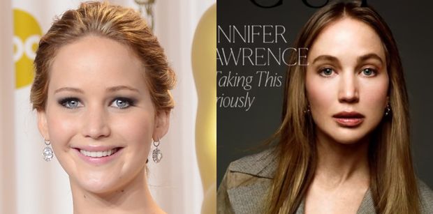 Lekarze wzięli pod lupę "NOWĄ TWARZ" (?) Jennifer Lawrence. Wymieniają, co MOGŁA SOBIE POPRAWIĆ