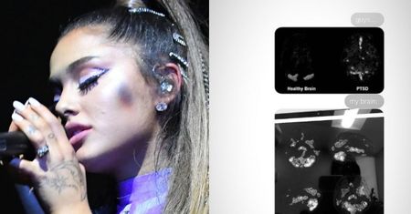 Ariana Grande pokazała skany swojego mózgu. "Ona też ma uczucia"