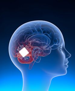 Firma Muska wszczepiła pierwszemu człowiekowi chip do mózgu