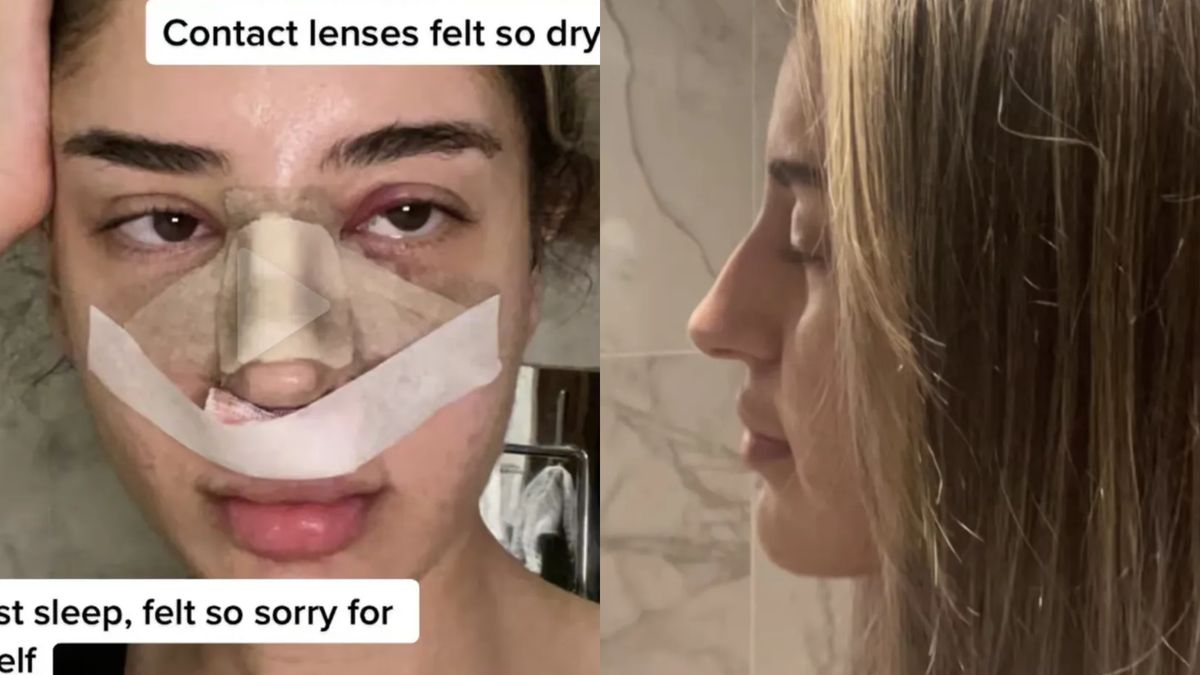 Zoperowała nos w Turcji. Tego się nie spodziewała