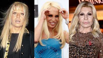 Tak na przestrzeni lat zmieniała się Donatella Versace. Ekspert wylicza, jakim zabiegom się poddała: operacja powiek, lifting szyi, rhinoplastyka, foxy eyes...
