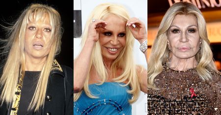 Tak na przestrzeni lat zmieniała się Donatella Versace. Ekspert wylicza, jakim zabiegom się poddała: operacja powiek, lifting szyi, rhinoplastyka, foxy eyes...