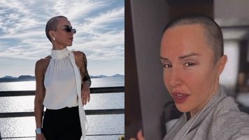 Blanka Lipińska mogła stracić wzrok. "Pies rozszarpał mi pół twarzy". Wraca do tragedii