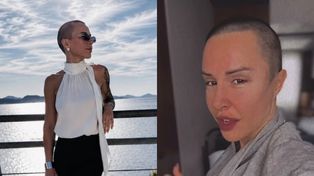 Blanka Lipińska mogła stracić wzrok. "Pies rozszarpał mi pół twarzy". Wraca do tragedii