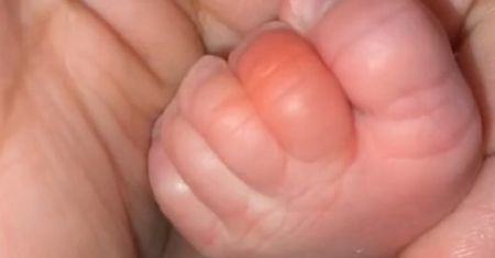 Włos owinięty wokół palca dziecka? Młoda mama ostrzega inne mamy