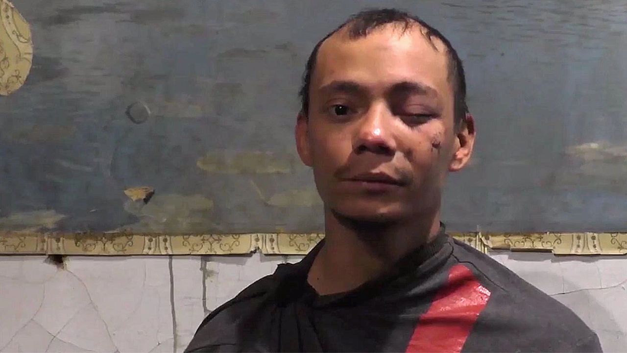 A Colombian captured by Russians. He faced the camera.
