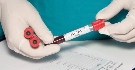 Nadzieja dla pacjentów. Odkryto przeciwciało skuteczne wobec HIV