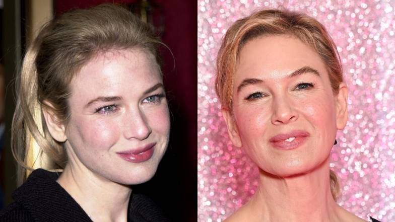 Renee Zellweger poprawiała urodę?