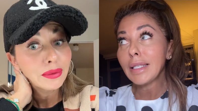 Po bolesnych doświadczeniach Izzy Anaya stanowczo odradza innym kobietom stosowanie wypełniaczy