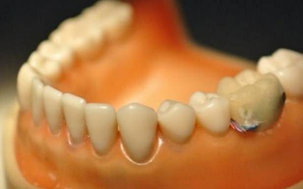 Szpieg w naszych ustach. Tajwańscy naukowcy stworzyli elektroniczny ząb