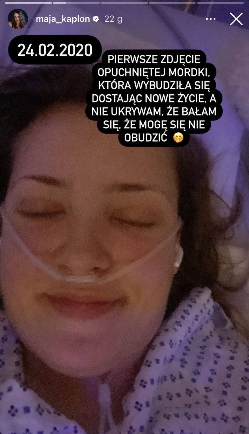 Maja Kapłon wspomina operację