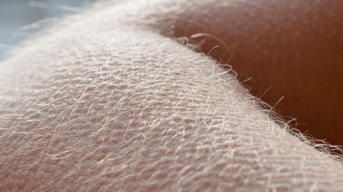 Uczulenie na słońce 