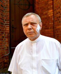 Szczecin. Pobicie księdza przez napastników. Sąd wydał wyrok