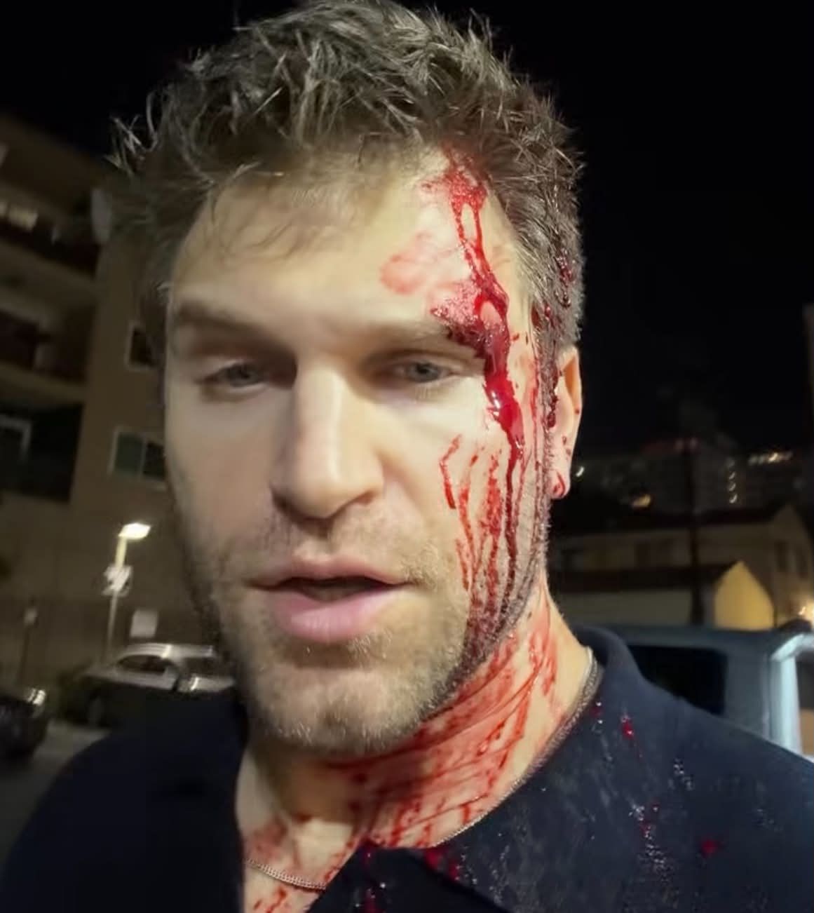 Keegan Allen